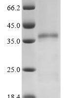 Human Heterogeneous nuclear ribonucleoproteins A2/B1 (HNRNPA2B1) Recombinant Protein, C-His, aa 1–353 - BioCrest Sci