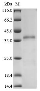 Human Heterogeneous nuclear ribonucleoproteins A2/B1 (HNRNPA2B1) Recombinant Protein, C-His, aa 1–353, Homo sapiens (Human), Yeast, C-terminal 6xHis-tagged, 38.5 kDa, purity >≥ 85% as determined by SDS-PAGE.