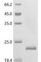 Notechis scutatus scutatus Basic phospholipase A2 notechis II-5 Recombinant Protein - BioCrest Sci