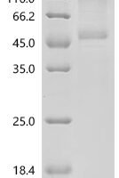 Mouse Bone morphogenetic protein 6 (Bmp6) Recombinant Protein, N-hFc1/C-10His - BioCrest Sci