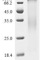 Human R3H domain-containing protein 2 (R3HDM2), partial Recombinant Protein, C-His, aa 751–976, Yeast - BioCrest Sci