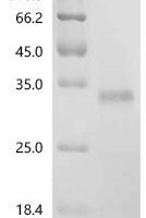 Human Otoancorin (OTOA), partial Recombinant Protein, N-His-SUMOstar - BioCrest Sci