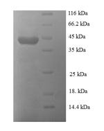 Human papillomavirus type 18 Regulatory protein E2 (E2) Recombinant Protein, N-His, aa 1–365, E.coli - BioCrest Sci