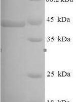 Pseudomonas aeruginosa Lysyl endopeptidase (prpL) Recombinant Protein - BioCrest Sci