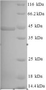 Pseudomonas aeruginosa Lysyl endopeptidase (prpL) Recombinant Protein, Pseudomonas aeruginosa (strain ATCC 15692 / PAO1 / 1C / PRS 101 / LMG 12228), E.coli, N-terminal 6xHis-SUMO-tagged, 42.4 kDa, purity >≥ 90% as determined by SDS-PAGE.