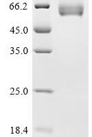 Human Leukocyte surface antigen CD47 (CD47), partial, Biotinylated Recombinant Protein, C-mFc-Avi - BioCrest Sci