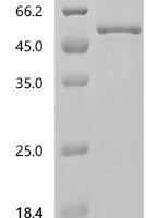 Human Interferon-inducible protein AIM2 (AIM2) Recombinant Protein - BioCrest Sci