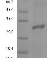 Rabbit Integrin beta-8 (ITGB8), partial Recombinant Protein, N-10His/C-Myc - BioCrest Sci