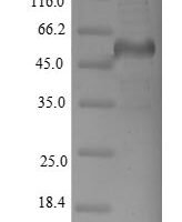 Human Dihydropyrimidinase-related protein 2 (DPYSL2) Recombinant Protein - BioCrest Sci
