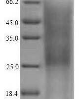 Mouse Complement receptor type 2 (Cr2), partial Recombinant Protein, N-His, aa 729–963, Yeast - BioCrest Sci