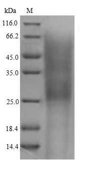 Mouse Complement receptor type 2 (Cr2), partial Recombinant Protein, N-His, aa 729–963, Yeast, Mus musculus (Mouse), Yeast, N-terminal 6xHis-tagged, 28.0 kDa, purity >≥ 90% as determined by SDS-PAGE.