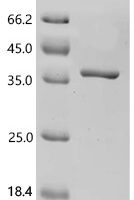 Human Glutamate--cysteine ligase regulatory subunit (GCLM) Recombinant Protein - BioCrest Sci