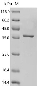 Human Glutamate--cysteine ligase regulatory subunit (GCLM) Recombinant Protein, Homo sapiens (Human), E.coli, C-terminal 6xHis-tagged, 37.6 kDa, purity >≥ 95% as determined by SDS-PAGE.
