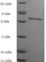 Human Leukosialin (SPN), partial Recombinant Protein, N-His-SUMO - BioCrest Sci