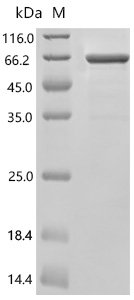 Human Perilipin-5 (PLIN5), partial, Biotinylated Recombinant Protein, Homo sapiens (Human), E.coli, N-terminal MBP-tagged and C-terminal 6xHis-Avi-tagged, 63.7 kDa, purity >≥ 85% as determined by SDS-PAGE.