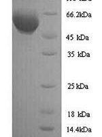 Mouse ATP synthase F(1) complex catalytic subunit beta, mitochondrial (Atp5f1b) Recombinant Protein, N-His - BioCrest Sci
