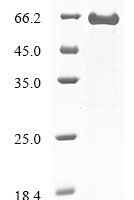 Human Spectrin alpha chain, erythrocytic 1 (SPTA1), partial Recombinant Protein, N-10His/C-Myc - BioCrest Sci