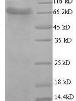 Bovine Acetylcholinesterase (ACHE) Recombinant Protein - BioCrest Sci