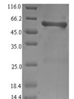 Salmonella typhi Outer membrane protein S1 (ompS1) Recombinant Protein - BioCrest Sci