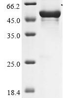 Human Hyaluronidase PH-20 (SPAM1) Recombinant Protein, N-His - BioCrest Sci