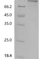 Nepenthes gracilis Aspartic proteinase nepenthesin-2 (nep2) Recombinant Protein, N-MBP/C-His - BioCrest Sci