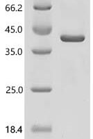 Human Hydroxysteroid 11-beta-dehydrogenase 1-like protein (HSD11B1L) Recombinant Protein - BioCrest Sci