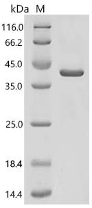 Human Hydroxysteroid 11-beta-dehydrogenase 1-like protein (HSD11B1L) Recombinant Protein, Homo sapiens (Human), E.coli, C-terminal 6xHis-tagged, 38.7 kDa, purity >≥ 85% as determined by SDS-PAGE.