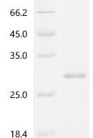Human Macrophage colony-stimulating factor 1 (CSF1), partial Recombinant Protein - BioCrest Sci