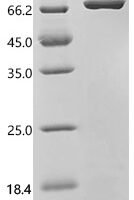 Mouse Proepiregulin (Ereg), partial Recombinant Protein, C-10His-HSA - BioCrest Sci