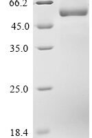 Human Cytochrome P450 7A1 (CYP7A1) Recombinant Protein - BioCrest Sci