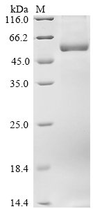 Human Cytochrome P450 7A1 (CYP7A1) Recombinant Protein, Homo sapiens (Human), E.coli, N-terminal 6xHis-tagged, 61.7 kDa, purity >≥ 85% as determined by SDS-PAGE.