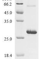 Chicken Pleiotrophin (PTN) Recombinant Protein - BioCrest Sci