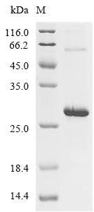 Chicken Pleiotrophin (PTN) Recombinant Protein, Gallus gallus (Chicken), E.coli, C-terminal 6xHis-tagged, 22.1 kDa, purity >≥ 85% as determined by SDS-PAGE.