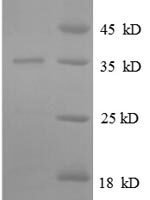 Escherichia coli 50S ribosomal protein L31 (rpmE) Recombinant Protein - BioCrest Sci