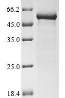 Vesicular stomatitis Indiana virus Nucleoprotein (N) Recombinant Protein - BioCrest Sci