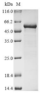 Vesicular stomatitis Indiana virus Nucleoprotein (N) Recombinant Protein, Vesicular stomatitis Indiana virus (strain San Juan) (VSIV), E.coli, N-terminal 10xHis-tagged and C-terminal Myc-tagged, 54.9 kDa, purity >≥ 85% as determined by SDS-PAGE.