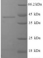 Human Deoxyguanosine kinase, mitochondrial (DGUOK) Recombinant Protein - BioCrest Sci