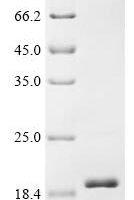 Klebsiella pneumoniae Outer membrane protein A (ompA), partial Recombinant Protein, Tag-Free - BioCrest Sci