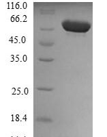 Human Cytoplasmic dynein 2 light intermediate chain 1 (DYNC2LI1) Recombinant Protein, N-GST - BioCrest Sci