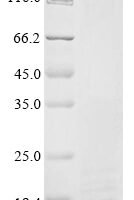 Escherichia coli Colicin-Ia (cia), partial Recombinant Protein - BioCrest Sci