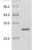 Human MHC class I polypeptide-related sequence B (MICB), partial Recombinant Protein, C-His, aa 25–198 - BioCrest Sci