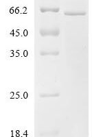 Mouse Perilipin-5 (Plin5) Recombinant Protein - BioCrest Sci