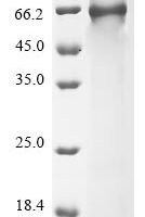Human Complement component C8 alpha chain (C8A) Recombinant Protein - BioCrest Sci