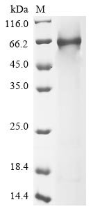Human Complement component C8 alpha chain (C8A) Recombinant Protein, Homo sapiens (Human), E.coli, N-terminal 6xHis-tagged, 65.8 kDa, purity >≥ 85% as determined by SDS-PAGE.