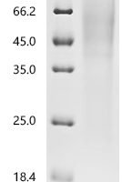 Human Low affinity immunoglobulin gamma Fc region receptor III-B (FCGR3B) Recombinant Protein - BioCrest Sci