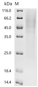 Human Low affinity immunoglobulin gamma Fc region receptor III-B (FCGR3B) Recombinant Protein, Homo sapiens (Human), Yeast, N-terminal 6xHis-tagged, 22.8 kDa, purity >≥ 95% as determined by SDS-PAGE.
