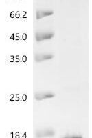 Human papillomavirus type 16 Truncated L2 protein (L2), partial Recombinant Protein - BioCrest Sci