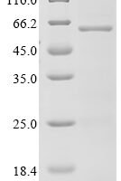 Human Gasdermin-D (GSDMD) Recombinant Protein, C-His - BioCrest Sci