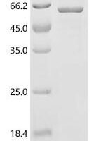 Human Rho guanine nucleotide exchange factor 18 (ARHGEF18), partial Recombinant Protein - BioCrest Sci