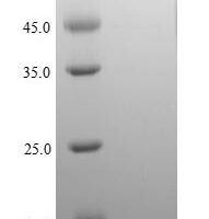 Escherichia coli Thiosulfate sulfurtransferase GlpE (glpE) Recombinant Protein, N-His, aa 1–108, E.coli - BioCrest Sci